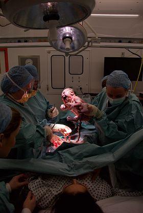 أصعب ولادة قيصرية بعد عمل 11 عملية من قبل